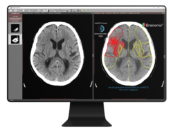 brain scans images on computer