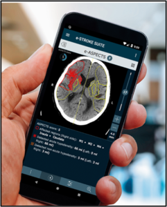brain scan image on smartphone